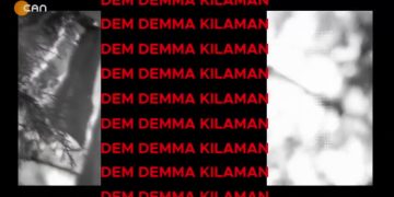 Serhat Med’in sunduğu Dem Demma Kılaman programı bugün konuk grup arjin ile birlikte sizlerle… 17.01.2022